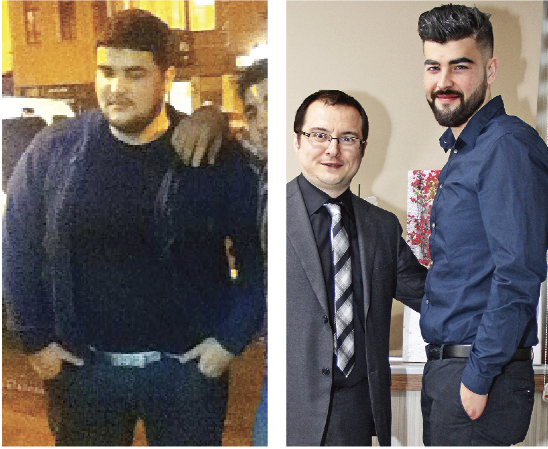 Opr. Dr. Fakı Akın anlattı: Şişmanlığa neşterli çözüm Opr. Dr. Fakı Akın anlattı: Şişmanlığa neşterli çözüm