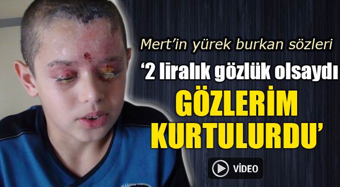 Deney sırasında yaralanan Mert, Fenerbahçe maçında Deney sırasında yaralanan Mert, Fenerbahçe maçında