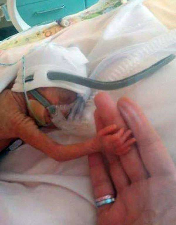 24 haftalık bebek buzdolabı poşetiyle hayata tutundu 24 haftalık bebek buzdolabı poşetiyle hayata tutundu